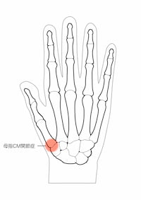 親指の付け根（CM関節）に痛みがある手のイラスト