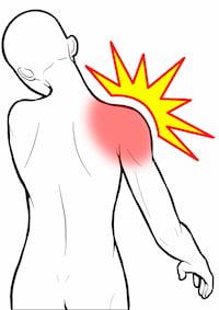 肩関節に強い痛みを感じている四十肩・五十肩のイラスト