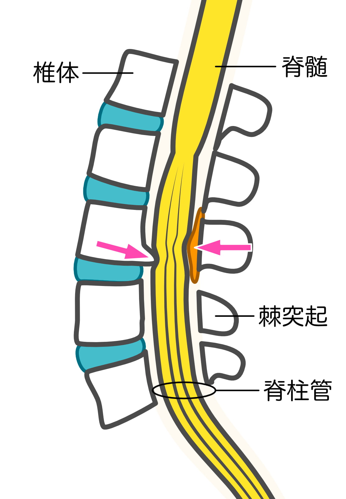腰部脊柱管狭窄症・脊柱管と神経の横断面図