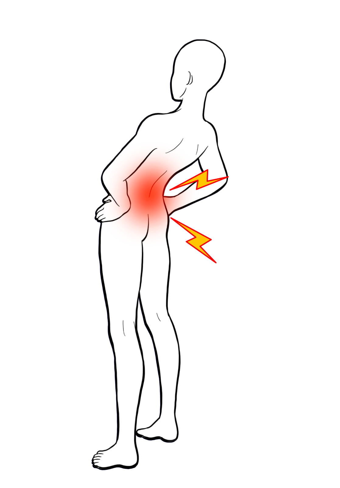 腰椎分離症・後屈で腰痛を訴える人のイラスト
