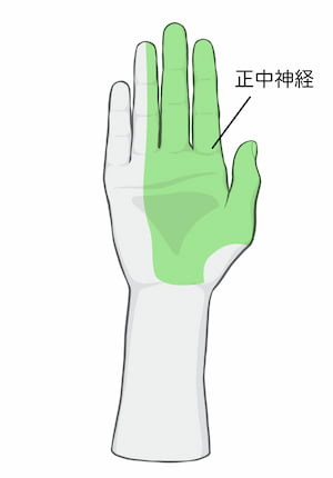 手のひらの正中神経の支配領域（しびれ範囲）を示す図